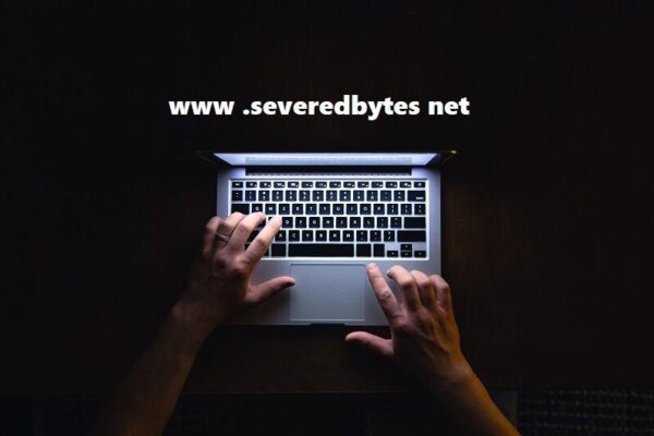 www .severedbytes net